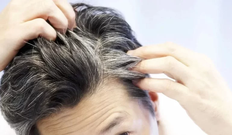 Kuaförler bunu öğrenince çok kızacak! Beyazlayan saçları eski rengine döndürmek bu kadar kolaymış! 1 saat bekletmeniz yeterli…